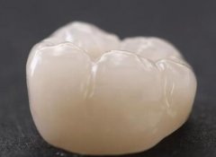 北京烤瓷牙多少钱一颗价格表2024