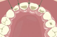 北京牙齿矫正可以用医保吗