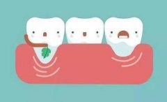 北京根管治疗报销比例是多少