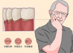 西安牙齿矫正大概要花费多少钱？牙齿矫正流程|矫正类型科普