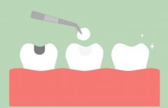 深圳根管治疗一颗牙多少钱？过程原理简单