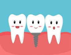 深圳种植牙多少钱一颗2024？种植牙好处分享