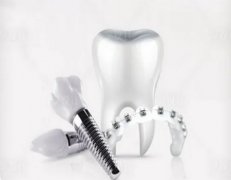 吃焦虑症的药可以种植牙齿吗？要通过医生评估