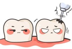 根管治疗的牙怎么矫正牙齿？佩戴矫正器