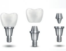 北京牙科收费价目表明细，附牙科医院推荐