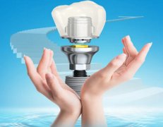 广州牙齿种植费用多少？注意事项分享