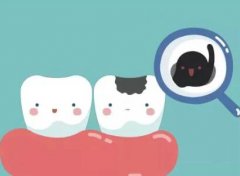 根管治疗的牙齿有牙根吗？根管只是去除炎症的牙髓组织