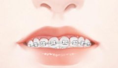 哈尔滨医科大学口腔医院尹晓东医生好不好？口碑良好，广受好评