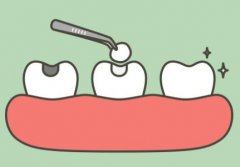 深圳牙齿种植多少钱？内附牙齿种植注意事项