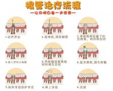 大牙齿根管治疗需要做几次？“一般需要做3~5次”