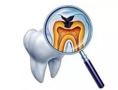 西安根管治疗收费标准明细公开，适合人群推荐