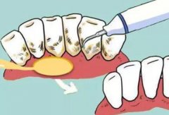 成都华西大口腔医院正畸科王军医生靠谱吗？经验丰富