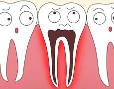 上海根管治疗医保可以报销吗？附报销注意事项