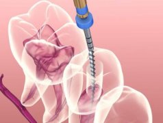 深圳口腔医院收费标准，拔牙和补牙一般价格100元起步