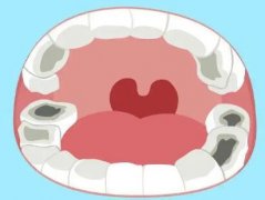 二手牙科根管治疗仪能用吗？附根管治疗仪使用科普