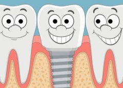 重庆种植牙多少钱一颗2024年，一般种植后可以保持十年时间
