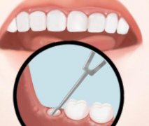 深圳牙齿种植能用医保报销吗？种植牙需要花费多久时间？