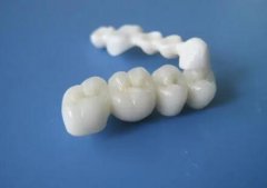 杭州烤瓷牙价目表公开，烤瓷牙后建议少吃坚硬食物