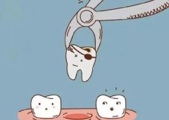 杭州牙科医院价格表，仅供参考