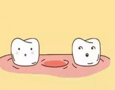 残缺的牙齿可否做烤瓷牙？牙齿缺失是什么原因?