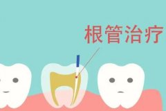 成都根管治疗可以医保报销吗？正规的医院就诊可以刷医保