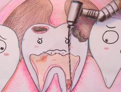 成都根管治疗医保报销吗？根据具体情况报销比例存在差异