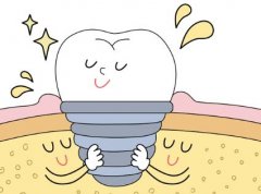 长沙种植牙多少钱一颗2024年？收费标准与选择的种植体材质有关