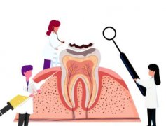 杭州种牙齿能用医保吗？种植牙并不在医保的报销范围内