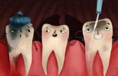 根管治疗后的牙齿能保持多久呢？保护得当时间大约是10年左右