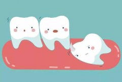 昆明牙齿矫正费用贵不贵?矫正方式不同导致价格不一样