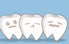 昆明根管治疗多少钱？大约为500元起一颗