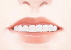 昆明烤瓷牙掉了重新粘一下多少钱