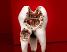 长沙牙齿种植是否纳入医保？需要患者自费