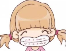 郑州牙齿矫正厉害的专家有哪些？附矫正所需花费科普