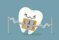 长沙根管治疗多少钱一颗牙齿？与牙齿部位有关