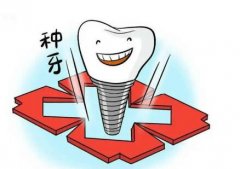 天津种牙多少钱一颗啊