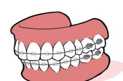 桐乡中医院口腔科姚燕萍怎么样？含医生资料、项目技术介绍
